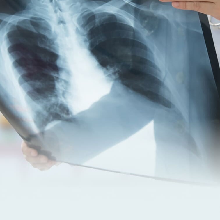 Doctor inspecting an X-Ray image of a person's chest