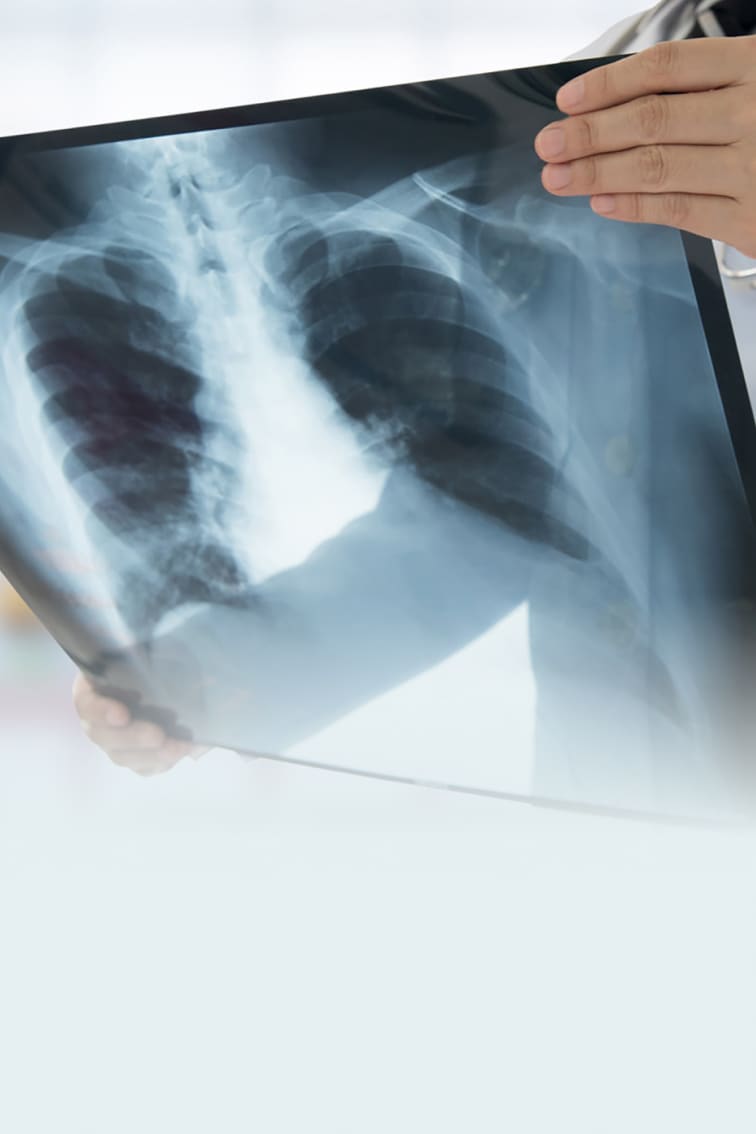Doctor inspecting an X-Ray image of a person's chest